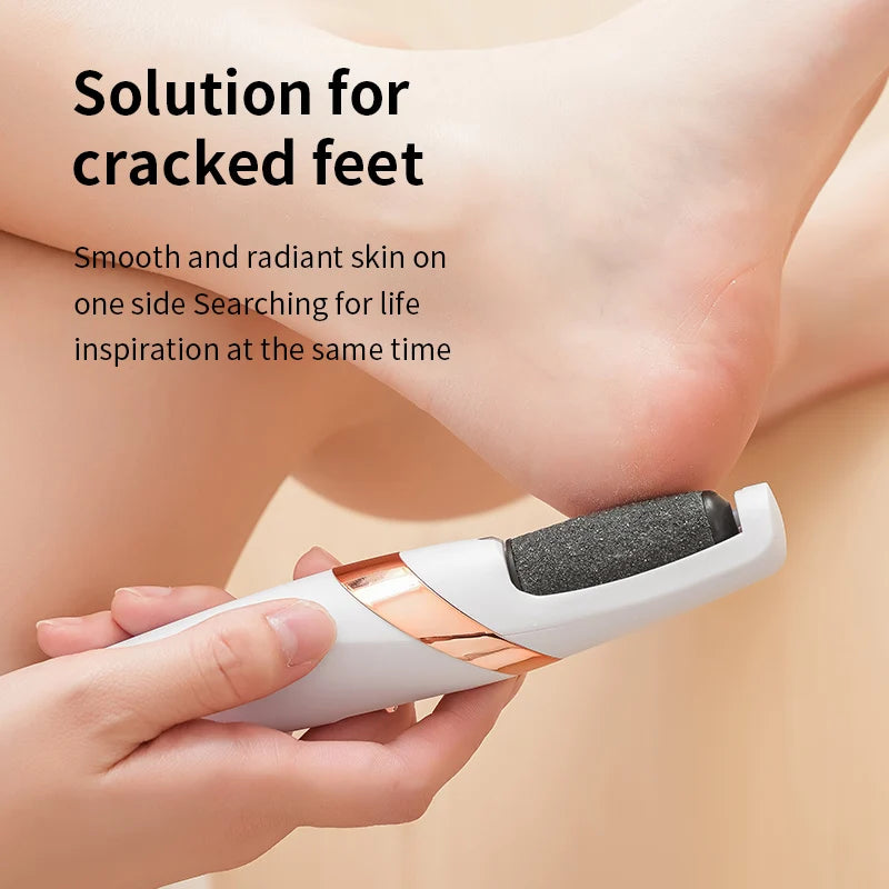 SoftStep™ Go – Râpe Électrique Rechargeable pour Pieds