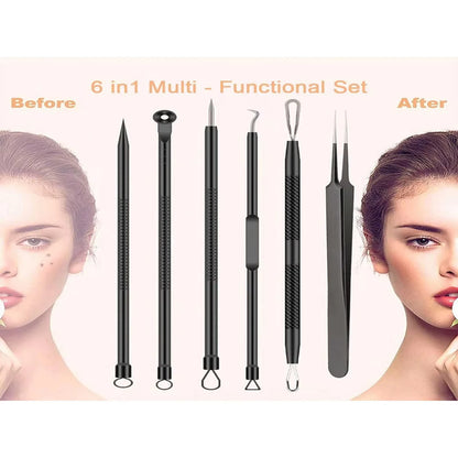 PurePore™ Pro – Professionelles Mitesserentfernungs-Kit