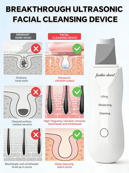 PureSonic™ Pro – Ultraschall-Gesichtsreinigungsspatel