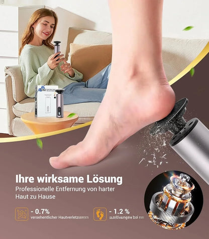 SoftStep™ Pro – Rechargeable Electric Foot File