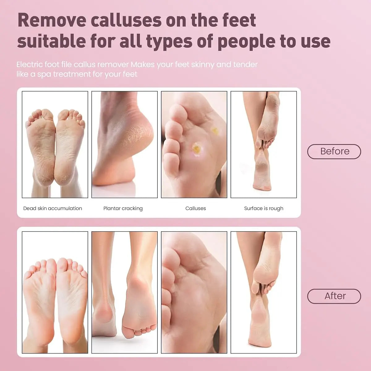 SoftStep™ Pro – Rechargeable Electric Foot File