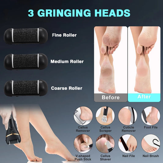 SoftStep™ Elite – Râpe Électrique Professionnelle pour Pieds
