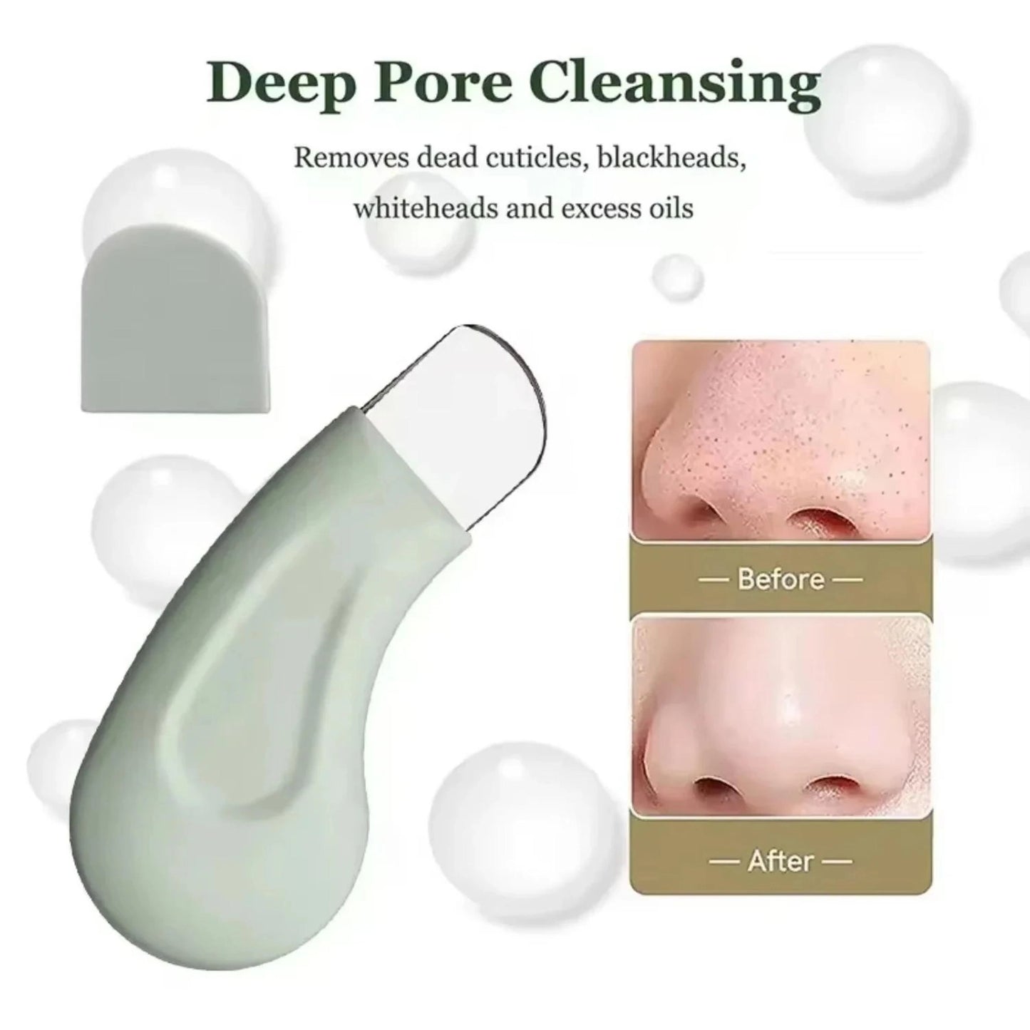 ClearPore™ Pro – Porenreinigungspatel aus Edelstahl