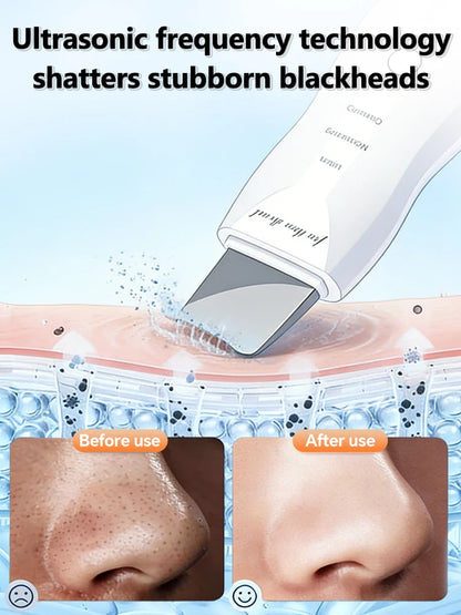 PureSonic™ Pro – Ultraschall-Gesichtsreinigungsspatel