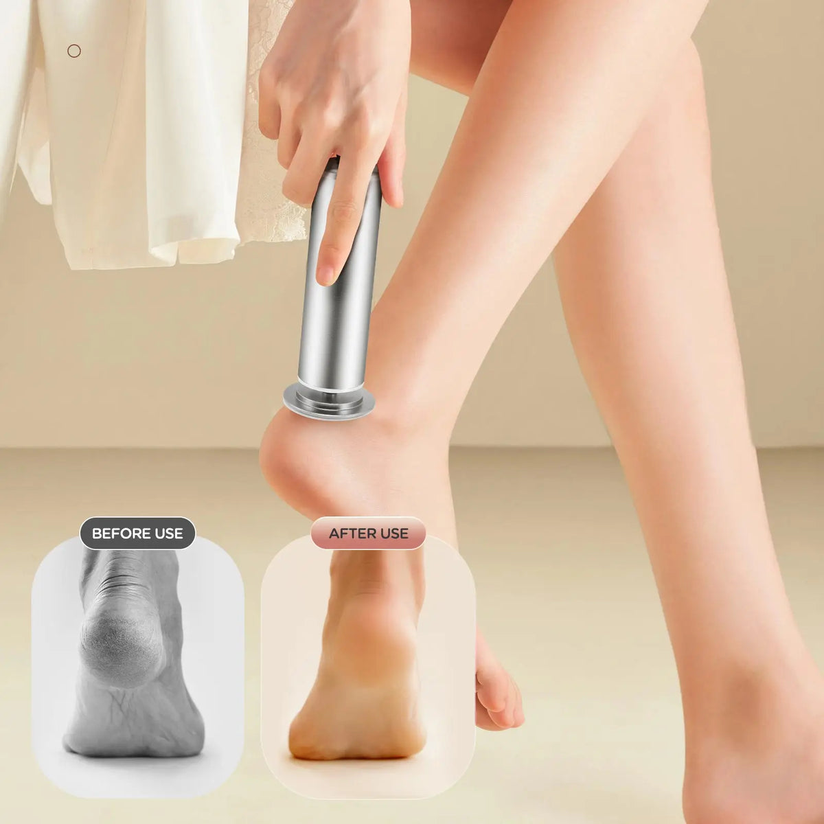 SoftStep™ Expert – Râpe Électrique Professionnelle pour Pieds