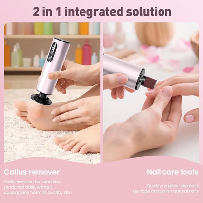 SoftStep™ Pro – Rechargeable Electric Foot File